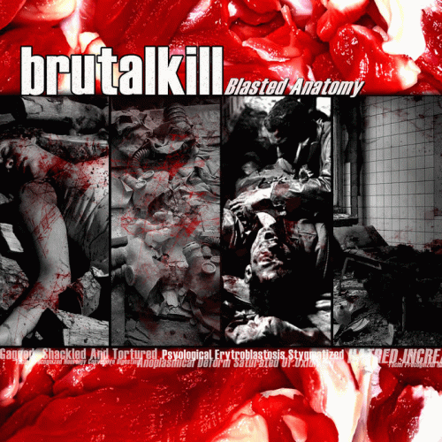 Brutalkill : Blasted Anatomy